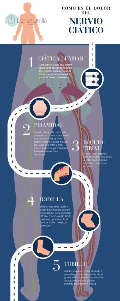 Cómo es el Dolor del Nervio Ciático
