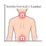 colocación electrodos tens lumbar