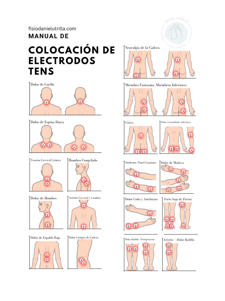 manual de colocación de electrodos tens