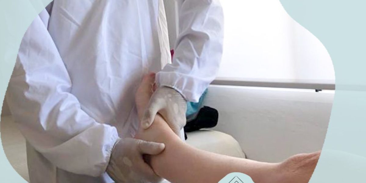 retención de líquidos en las piernas síntomas y causas